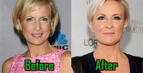 mika brzezinski face lift pictures.